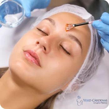Medellín Peeling Dr Yesid Cárdenas