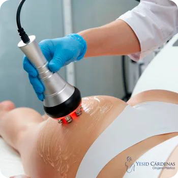 Medellín Venus Legacy