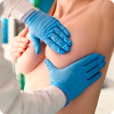 Medellin mastopexia levantamiento