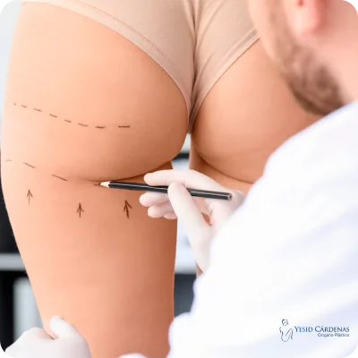 Reducción de gluteos medellin