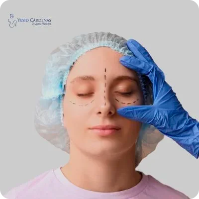 medellin colombia blefaroplastia
